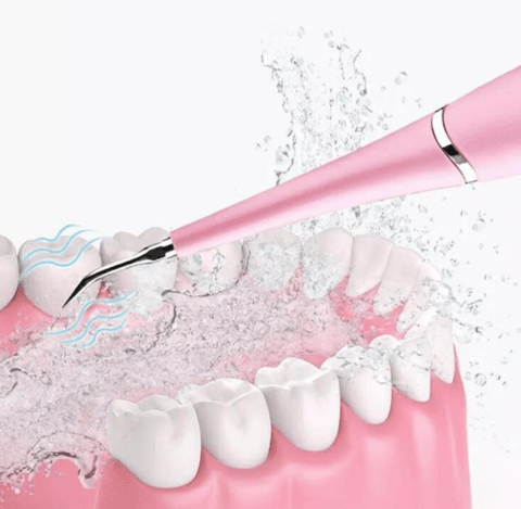 Détartreur Dentaire Électrique - ZINAMI.SHOP