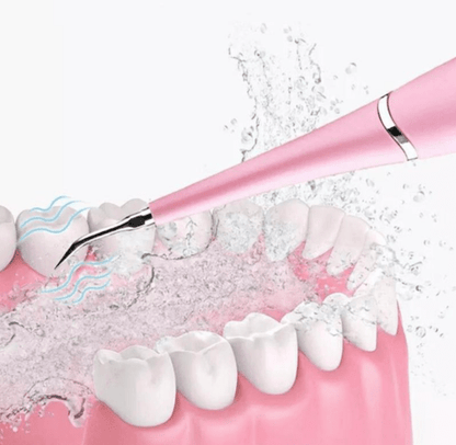 Détartreur Dentaire Électrique - ZINAMI.SHOP